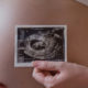 Maternal-fetal medicine