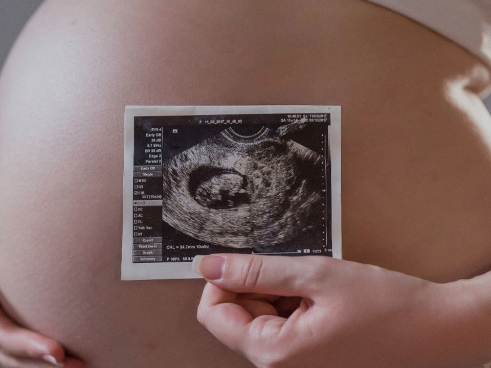 Maternal fetal medicine