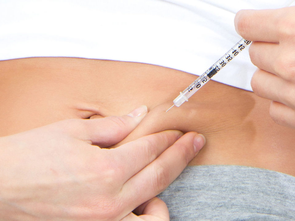 Artificial insemination