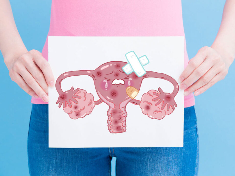 Cáncer de cuello uterino