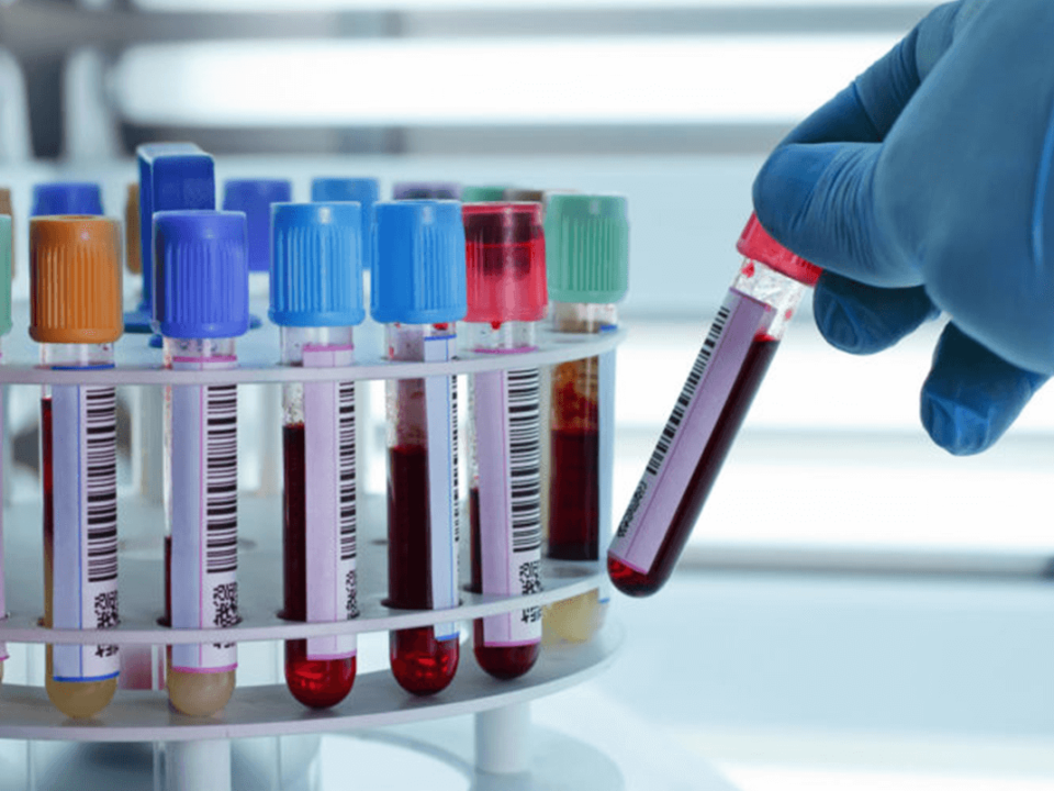 Estudios prenatales para embarazadas