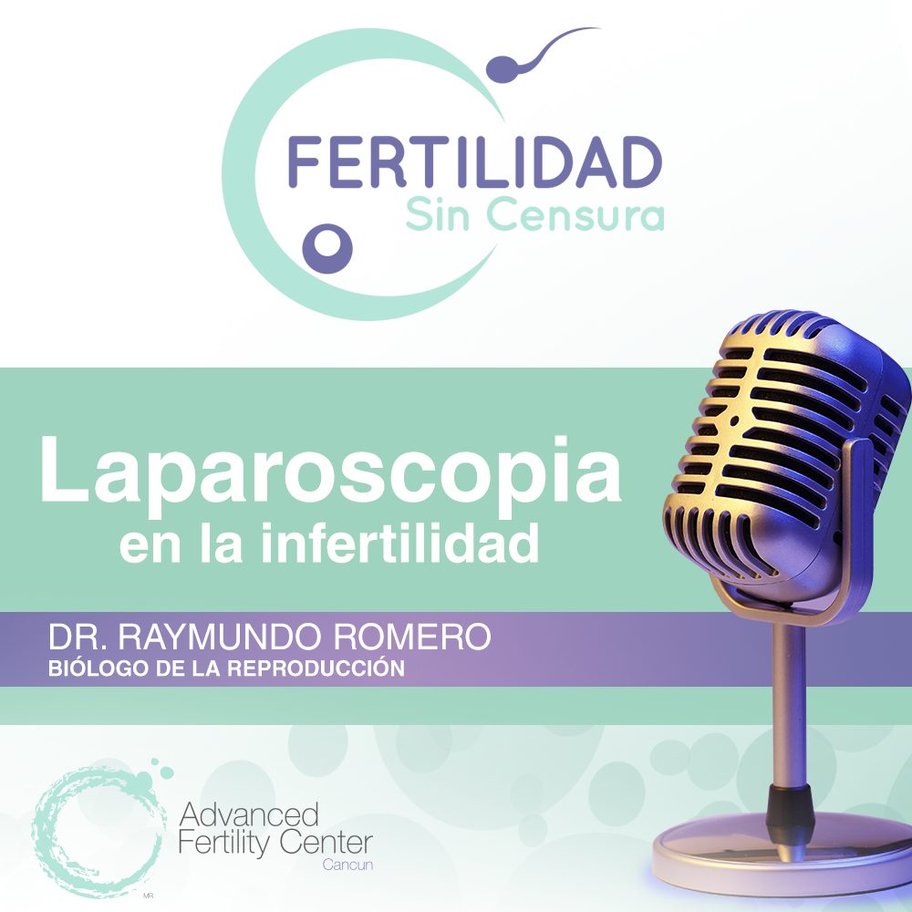 Laparoscopia en la infertilidad